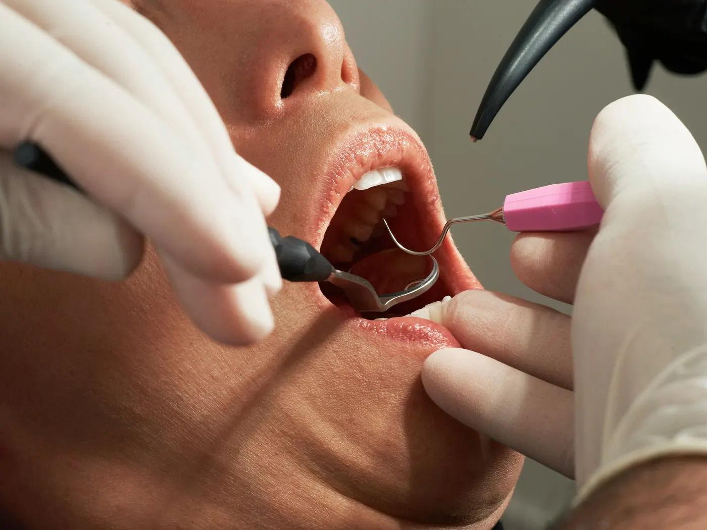 A dentist examining a patient's gums